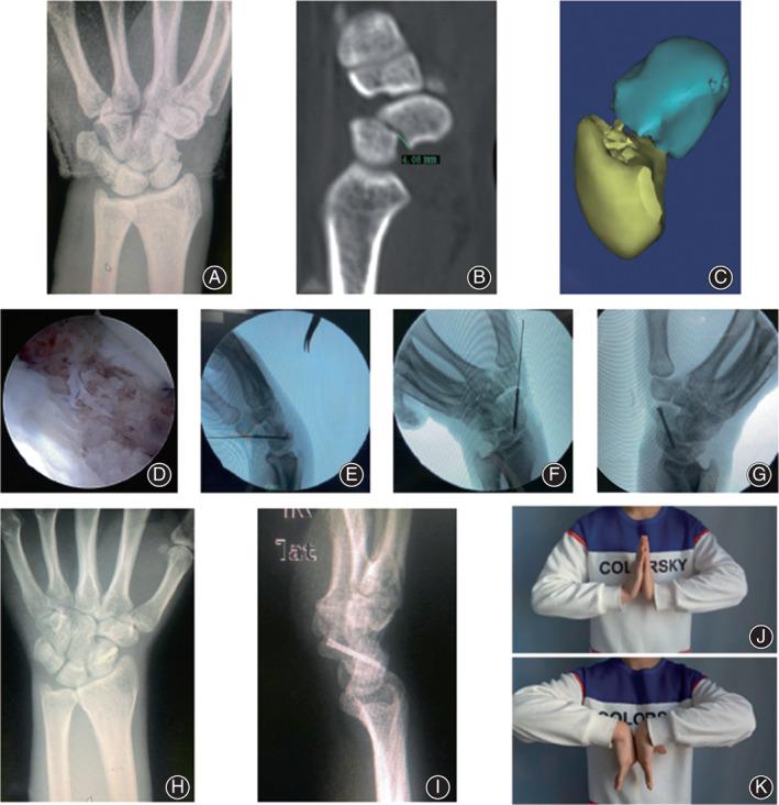 https://cdn.ncbi.nlm.nih.gov/pmc/blobs/e79a/9732583/b6876320944e/OS-14-3187-g002.jpg