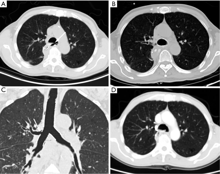 https://cdn.ncbi.nlm.nih.gov/pmc/blobs/e7a4/8339849/b861d1826fad/atm-09-13-1051-f5.jpg