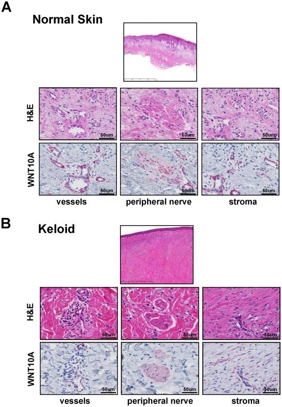 https://cdn.ncbi.nlm.nih.gov/pmc/blobs/e7a8/3009728/55beb3eaa4ed/pone.0015330.g006.jpg