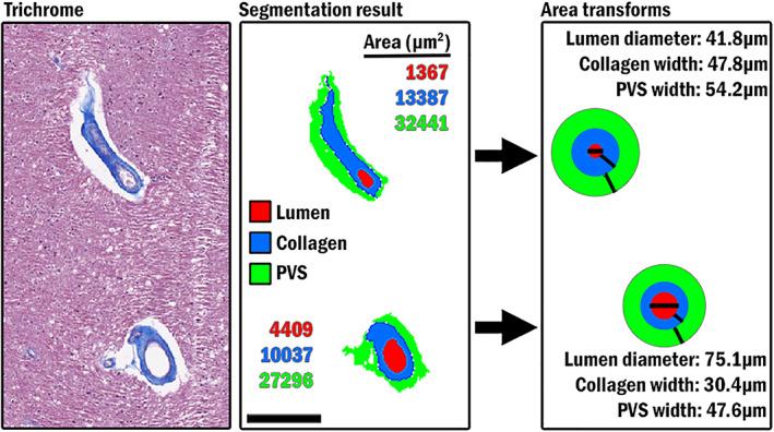 https://cdn.ncbi.nlm.nih.gov/pmc/blobs/e7bf/9826250/01b4b0903316/ANA-92-992-g001.jpg