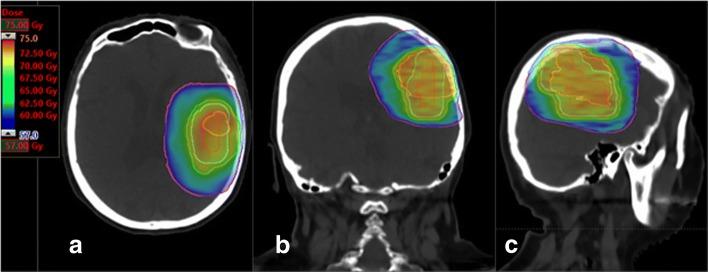 https://cdn.ncbi.nlm.nih.gov/pmc/blobs/e7c0/6385401/0f444b97b723/12885_2019_5317_Fig5_HTML.jpg