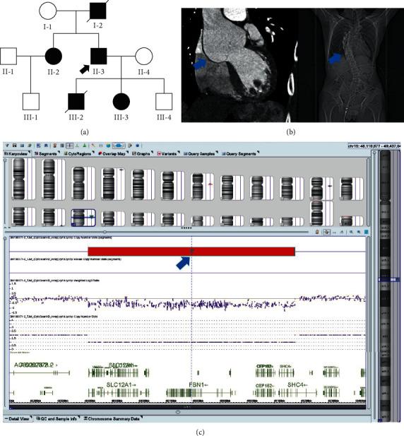https://cdn.ncbi.nlm.nih.gov/pmc/blobs/e7c2/9005307/ea062721034b/GR2022-3556302.001.jpg