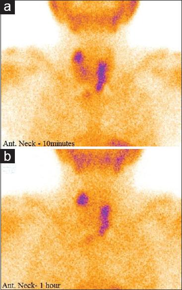 https://cdn.ncbi.nlm.nih.gov/pmc/blobs/e7c9/7905269/508fba49491f/IJNM-35-333-g001.jpg