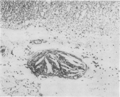 https://cdn.ncbi.nlm.nih.gov/pmc/blobs/e7cd/1145463/ff3612e7a5e0/jclinpath00446-0076-b.jpg