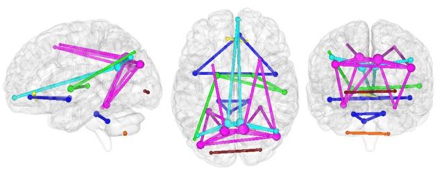 https://cdn.ncbi.nlm.nih.gov/pmc/blobs/e7d0/5013043/d4b99015ff5c/fnins-10-00380-g0002.jpg