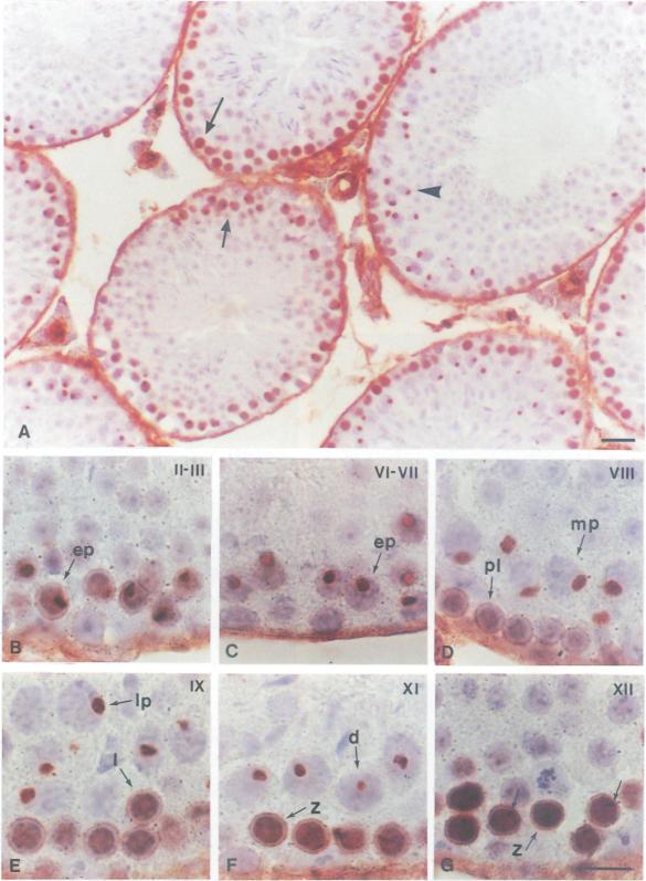 https://cdn.ncbi.nlm.nih.gov/pmc/blobs/e7d8/394783/0a953f23276a/emboj00049-0113-a.jpg