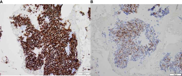 https://cdn.ncbi.nlm.nih.gov/pmc/blobs/e7db/9373049/554e9bc6ab8d/fonc-12-967386-g008.jpg