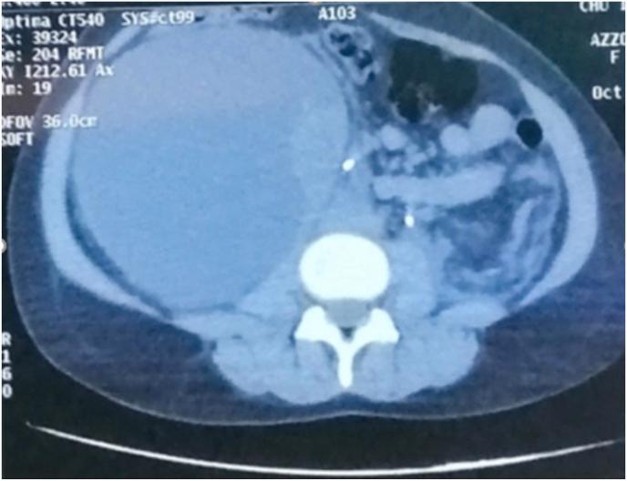 https://cdn.ncbi.nlm.nih.gov/pmc/blobs/e7dc/11137504/d485ac07dae3/gr1.jpg