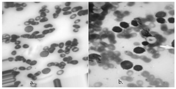 https://cdn.ncbi.nlm.nih.gov/pmc/blobs/e7dc/11273433/7b838ef47686/bioengineering-11-00644-g004.jpg