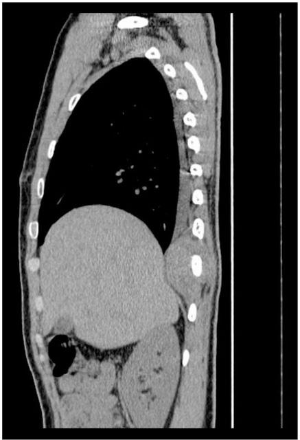 https://cdn.ncbi.nlm.nih.gov/pmc/blobs/e7e2/3266582/f3ce81e1013b/ci11002502.jpg