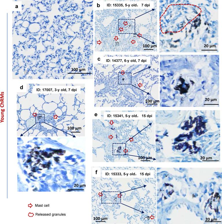 https://cdn.ncbi.nlm.nih.gov/pmc/blobs/e7e3/8683491/54b84ce76a2d/41392_2021_849_Fig2_HTML.jpg