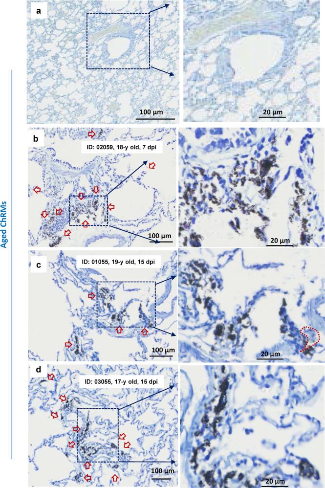 https://cdn.ncbi.nlm.nih.gov/pmc/blobs/e7e3/8683491/55ebbca65bd7/41392_2021_849_Fig3_HTML.jpg