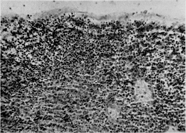 https://cdn.ncbi.nlm.nih.gov/pmc/blobs/e7e5/2599747/7fa361a5470a/yjbm00307-0041-b.jpg