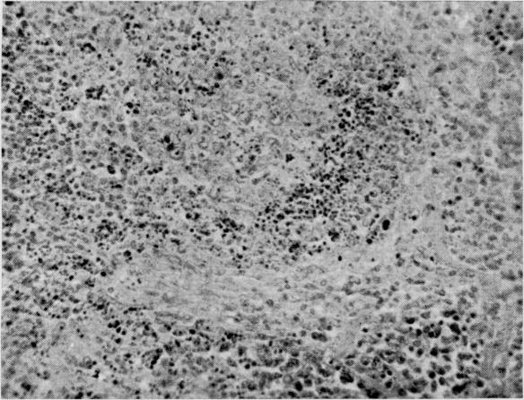 https://cdn.ncbi.nlm.nih.gov/pmc/blobs/e7e5/2599747/b78c43420bbb/yjbm00307-0042-b.jpg
