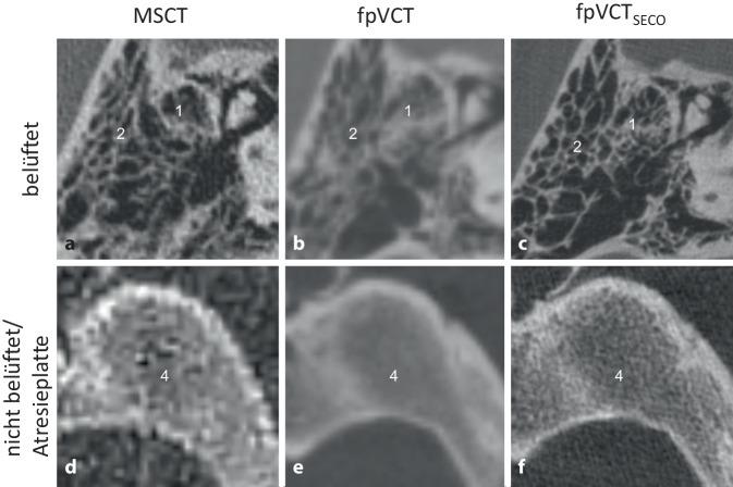 https://cdn.ncbi.nlm.nih.gov/pmc/blobs/e802/11499392/4fdaaa7fa020/106_2024_1511_Fig4_HTML.jpg