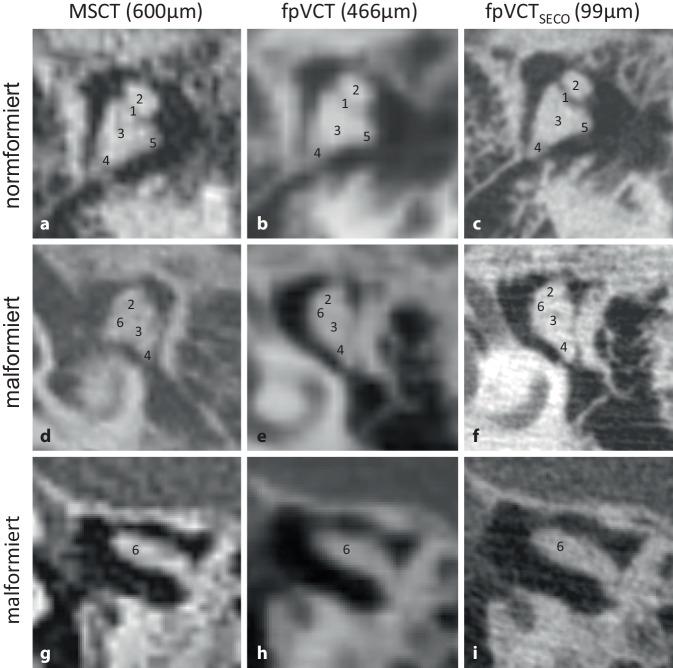 https://cdn.ncbi.nlm.nih.gov/pmc/blobs/e802/11499392/78e8c493f0d5/106_2024_1511_Fig2_HTML.jpg