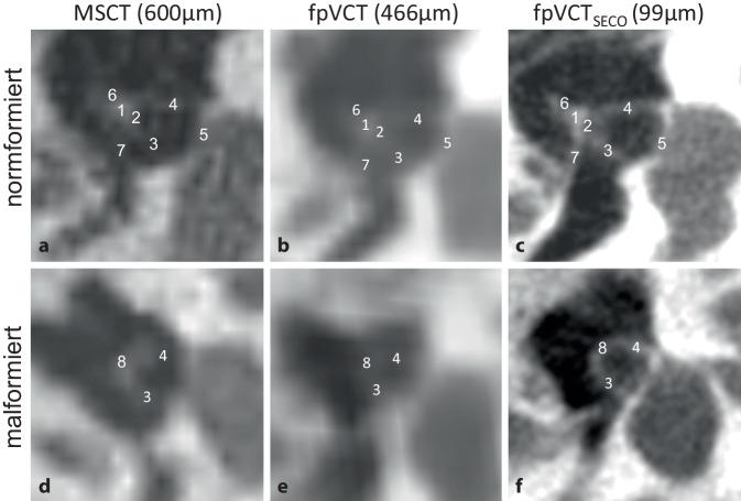 https://cdn.ncbi.nlm.nih.gov/pmc/blobs/e802/11499392/c7bcad9730ce/106_2024_1511_Fig1_HTML.jpg
