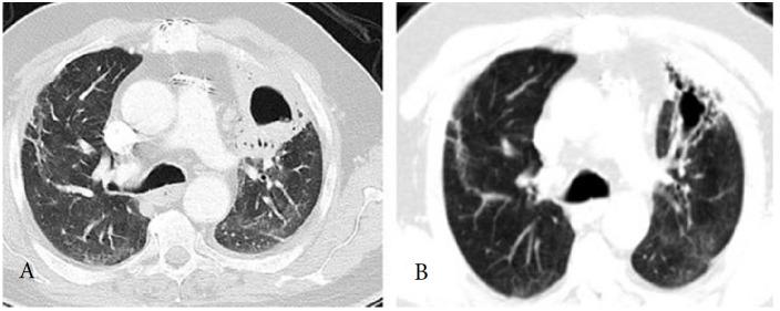 https://cdn.ncbi.nlm.nih.gov/pmc/blobs/e805/8771021/99215474414e/turkjmedsci-51-3359-fig002.jpg