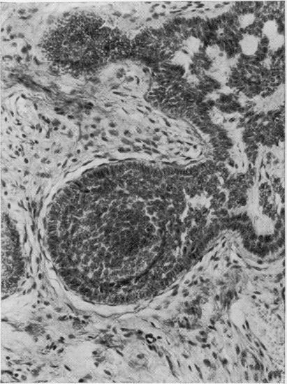 https://cdn.ncbi.nlm.nih.gov/pmc/blobs/e80f/476809/2907c964326e/jclinpath00086-0007-a.jpg