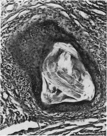 https://cdn.ncbi.nlm.nih.gov/pmc/blobs/e80f/476809/358351bba638/jclinpath00086-0009-c.jpg