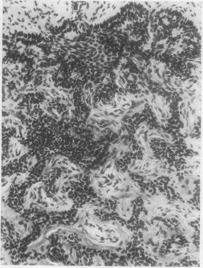 https://cdn.ncbi.nlm.nih.gov/pmc/blobs/e80f/476809/c5f32dd3bd4e/jclinpath00086-0010-b.jpg