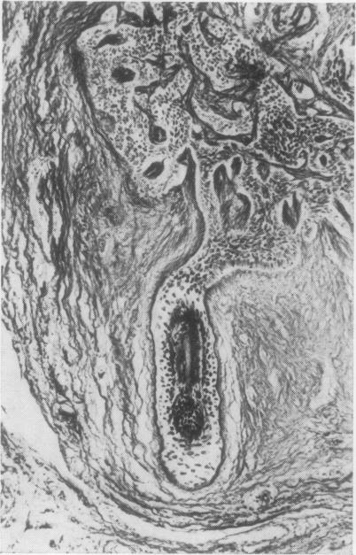 https://cdn.ncbi.nlm.nih.gov/pmc/blobs/e80f/476809/dfc9943d286f/jclinpath00086-0010-c.jpg
