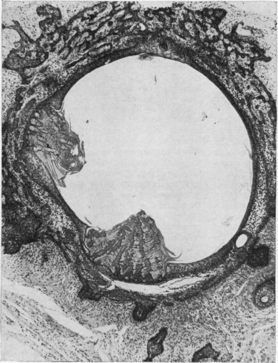 https://cdn.ncbi.nlm.nih.gov/pmc/blobs/e80f/476809/eb05f0ed55fe/jclinpath00086-0011-b.jpg