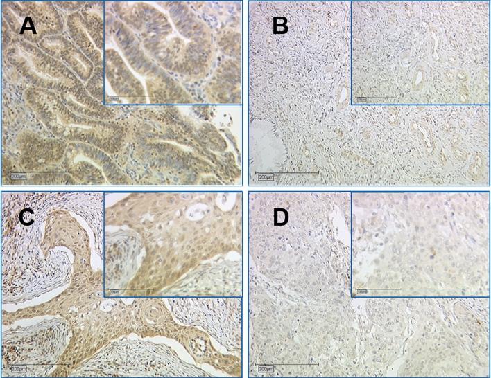 https://cdn.ncbi.nlm.nih.gov/pmc/blobs/e815/8490237/bc066b3ca7e6/404_2021_6053_Fig1_HTML.jpg