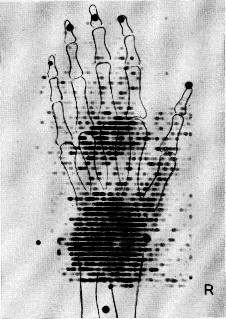 https://cdn.ncbi.nlm.nih.gov/pmc/blobs/e818/1900902/08402abb02b0/procrsmed00183-0052-a.jpg