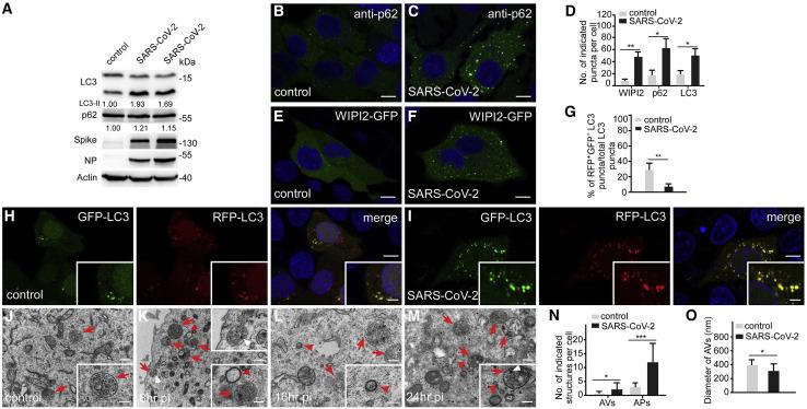 https://cdn.ncbi.nlm.nih.gov/pmc/blobs/e81d/7832235/d4607dd239af/gr2_lrg.jpg