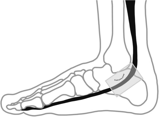 https://cdn.ncbi.nlm.nih.gov/pmc/blobs/e81f/10908900/b4bb9283b7c5/40477_2023_793_Fig1_HTML.jpg