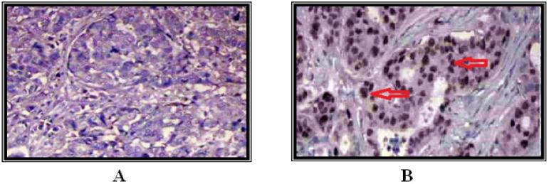 https://cdn.ncbi.nlm.nih.gov/pmc/blobs/e823/10762755/fa49fae8e1ac/APJCP-24-3261-g003.jpg