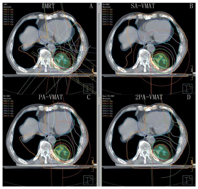 https://cdn.ncbi.nlm.nih.gov/pmc/blobs/e824/5795944/dc15db8bf86a/ol-15-03-3735-g05.jpg