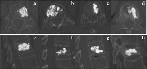 https://cdn.ncbi.nlm.nih.gov/pmc/blobs/e827/5806350/dd287022e0cd/13018_2018_733_Fig1_HTML.jpg