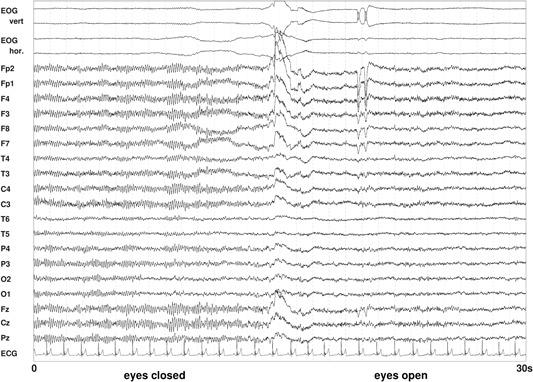 https://cdn.ncbi.nlm.nih.gov/pmc/blobs/e829/6619284/e1db730f997c/BEM-40-291-g007.jpg