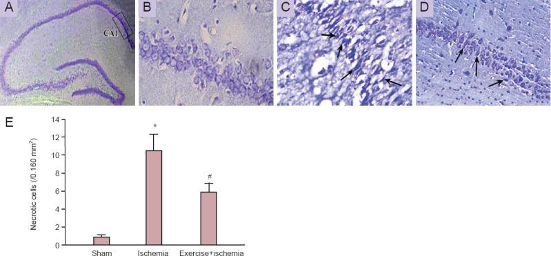 https://cdn.ncbi.nlm.nih.gov/pmc/blobs/e836/4590236/dd4ffd19a41d/NRR-10-1245-g002.jpg