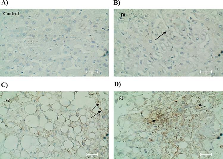 https://cdn.ncbi.nlm.nih.gov/pmc/blobs/e83b/10734958/d46d42d4df7a/pone.0295839.g003.jpg