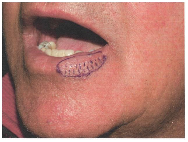 https://cdn.ncbi.nlm.nih.gov/pmc/blobs/e83d/8200802/85489da27f8d/etm-22-02-10258-g08.jpg