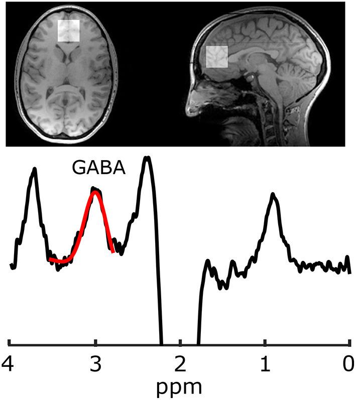 https://cdn.ncbi.nlm.nih.gov/pmc/blobs/e840/8144302/9882bea2257d/fpsyt-12-665402-g0001.jpg