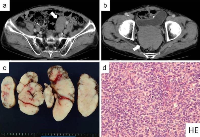 https://cdn.ncbi.nlm.nih.gov/pmc/blobs/e84f/3432999/adeedb2640d7/cro-0005-0420-g02.jpg