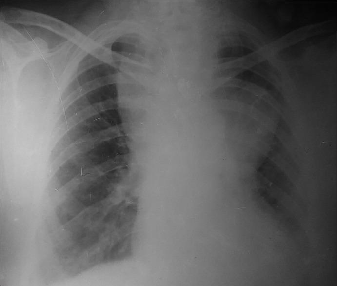 https://cdn.ncbi.nlm.nih.gov/pmc/blobs/e854/5341636/12256284146d/AER-11-110-g006.jpg