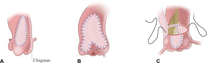 https://cdn.ncbi.nlm.nih.gov/pmc/blobs/e856/5858638/9545b0f70d81/10.1177_2150135117745004-fig1.jpg