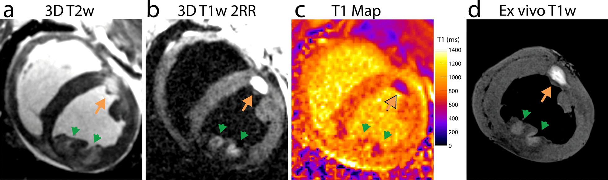 https://cdn.ncbi.nlm.nih.gov/pmc/blobs/e858/8101152/cc365f24cfd4/12968_2020_693_Fig1_HTML.jpg