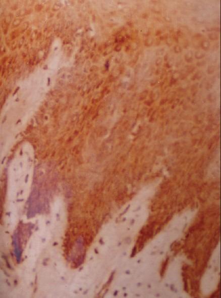 https://cdn.ncbi.nlm.nih.gov/pmc/blobs/e862/3424932/03804c3f4edc/JOMFP-16-183-g006.jpg