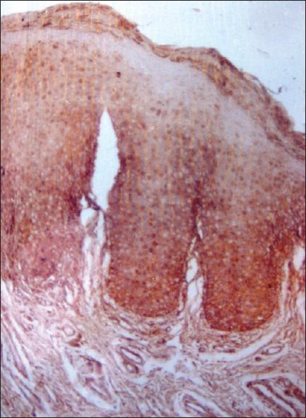 https://cdn.ncbi.nlm.nih.gov/pmc/blobs/e862/3424932/585ece2f6de9/JOMFP-16-183-g009.jpg