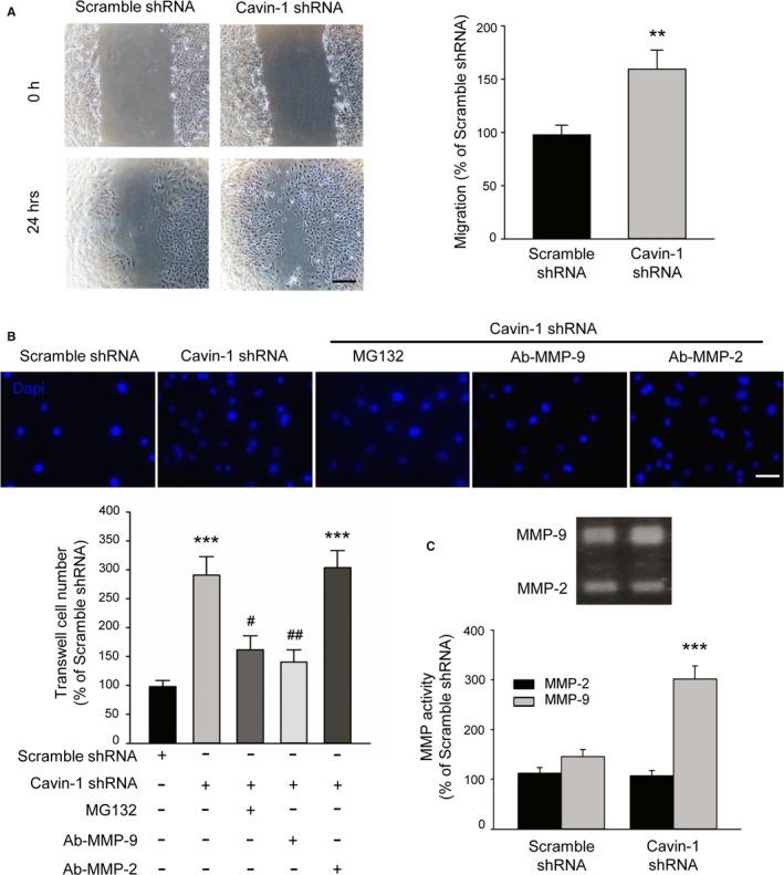 https://cdn.ncbi.nlm.nih.gov/pmc/blobs/e868/5586430/78f9ba1b43f0/JAH3-6-e005754-g005.jpg