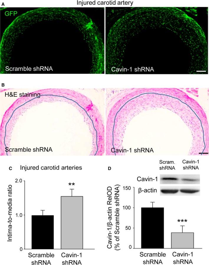 https://cdn.ncbi.nlm.nih.gov/pmc/blobs/e868/5586430/b3bcb944b8f1/JAH3-6-e005754-g003.jpg