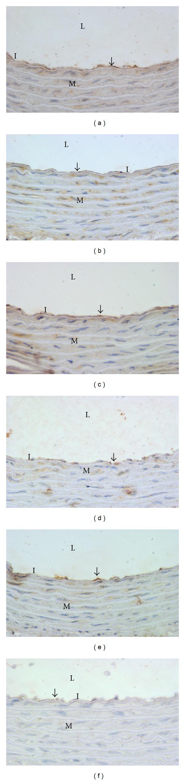 https://cdn.ncbi.nlm.nih.gov/pmc/blobs/e869/3616353/2b9dc17703a8/ECAM2013-976967.005.jpg