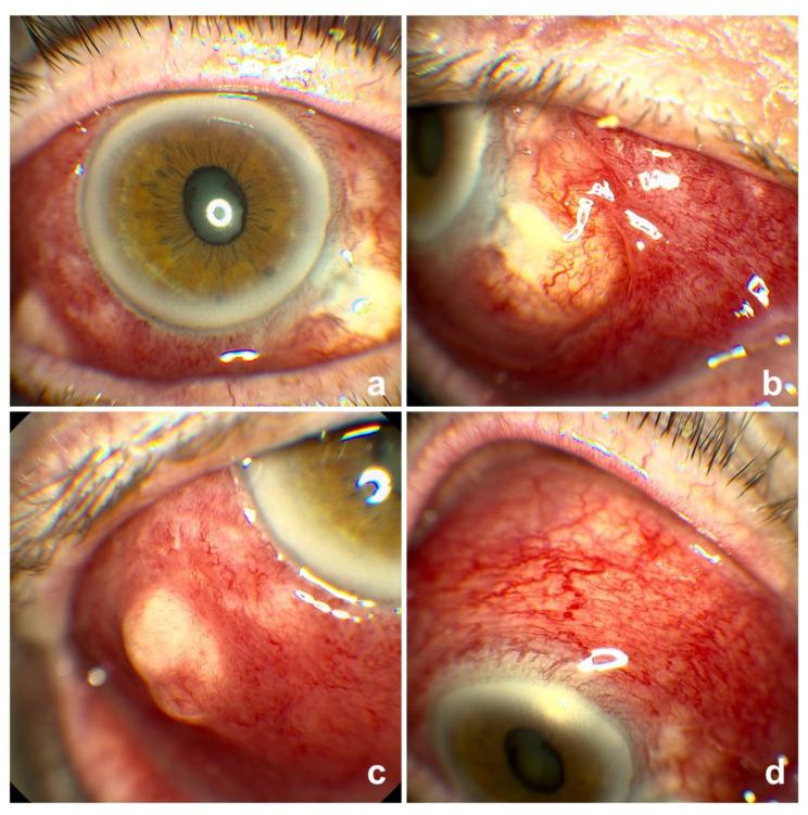 https://cdn.ncbi.nlm.nih.gov/pmc/blobs/e86c/7356894/6372e8b89263/vision-04-00024-g001.jpg