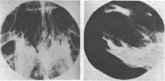 https://cdn.ncbi.nlm.nih.gov/pmc/blobs/e870/1603699/cc20ca9c18b4/brmedj00120-0012-a.jpg